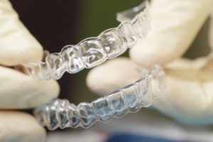 clear braces - invisalign